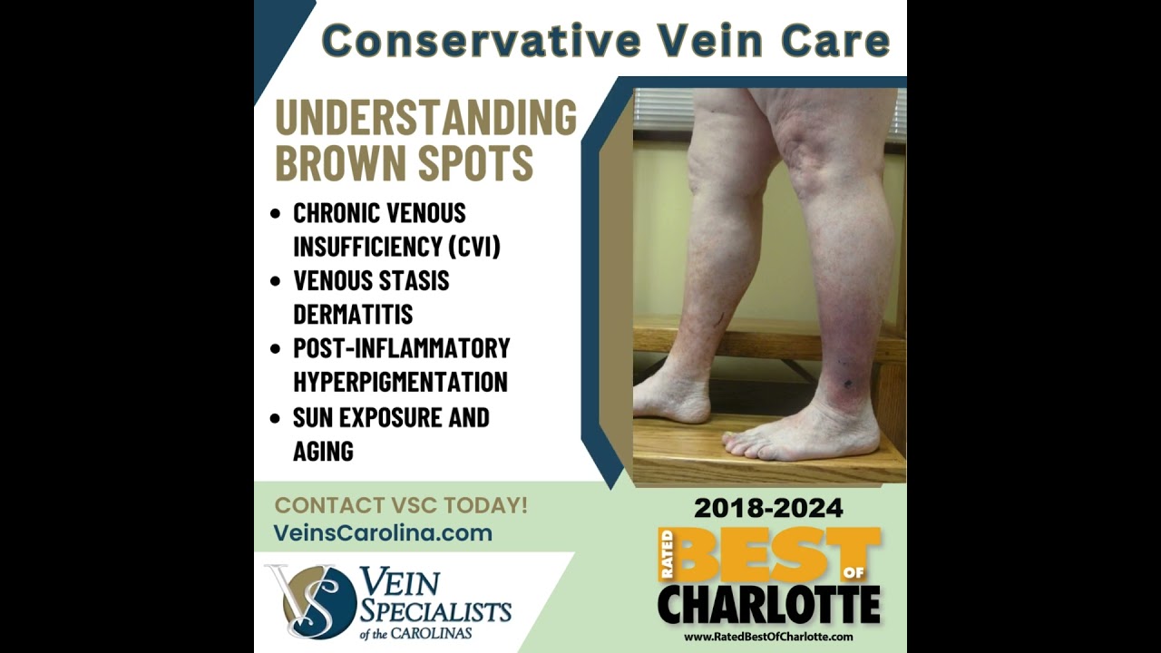 What Causes Brown Spots On Your Lower Legs In Thailand - Infoupdate.org