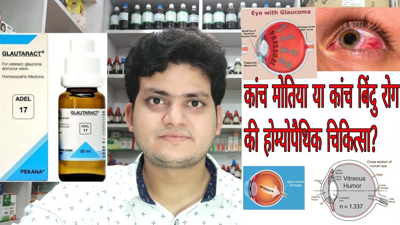 Glucoma ! कांच मोतिया या कांच बिंदु रोग ! Homeopathic Medicine for