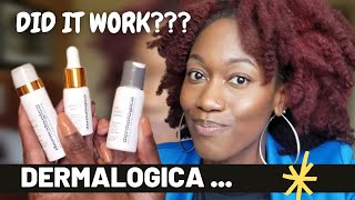 DID IT WORK??? | QUICK REVIEW | Dermalogica Daily Brightness Boosters Kit | Acne | Oily | Dark Skin