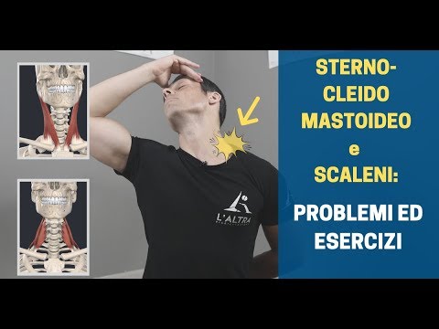 Video: Perché il mio sternocleidomastoideo è gonfio?