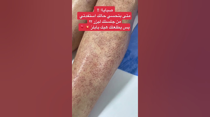 الجسم بعد الليزر#shorts
