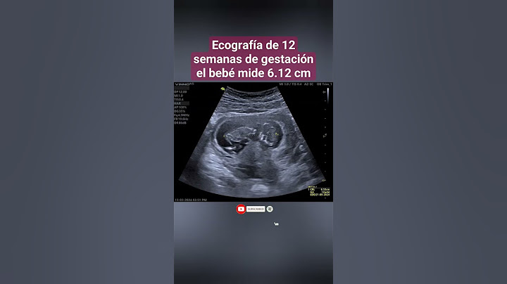 12-WEEK PREGNANCY, BABY MEASURES 6 CM
