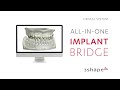 3shape dental system  allinone implant bridge