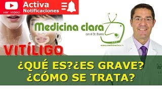 ¿Por qué salen manchas blancas en la cara y cómo se quitan?