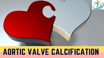 Aortic Valve Calcification