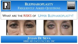 Risks of Upper Blepharoplasty | Upper Eyelid Surgery FAQ