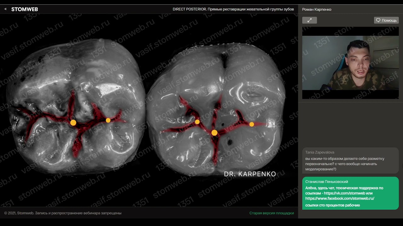 Роман Карпенко - DIRECT POSTERIOR. Прямые реставрации жевательной группы зубов
