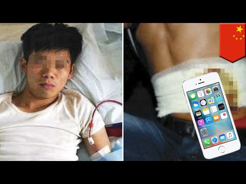 Pria jual ginjal untuk beli Iphone kini lumpuh - TomoNews