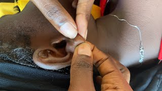 ASMR EAR PICKING, EAR HOLE PIERCING CLEANING ON A REAL PERSON WITH GUM CHEWING