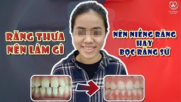 Răng Thưa Nên Làm Gì? Niềng Răng Hay Bọc Răng Sứ | Các Case Lâm Sàng #13