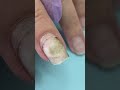 What Happened 🤢After Using Nail Glue