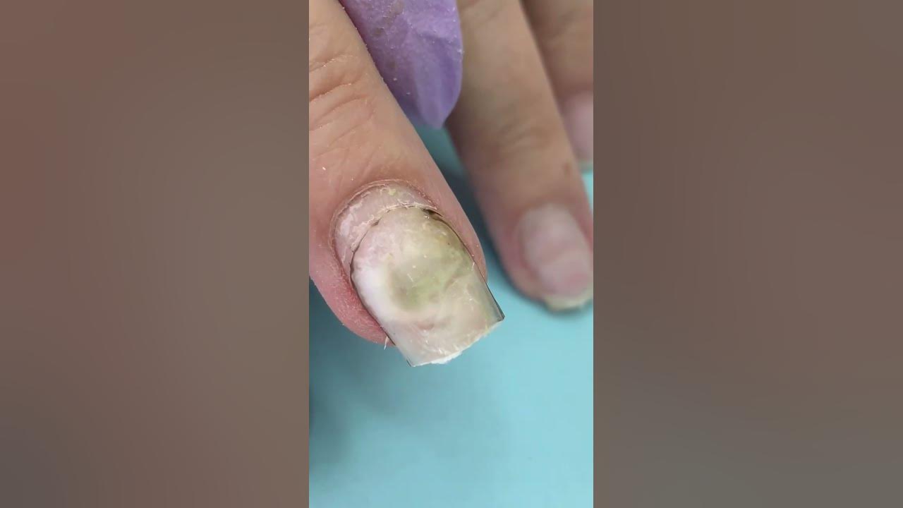What Happened 🤢After Using Nail Glue