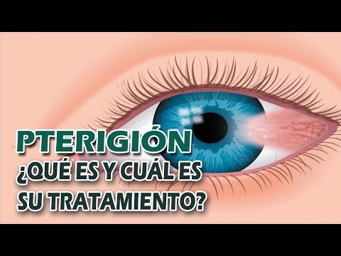 Video: ¿Por qué el pterion es clínicamente significativo?