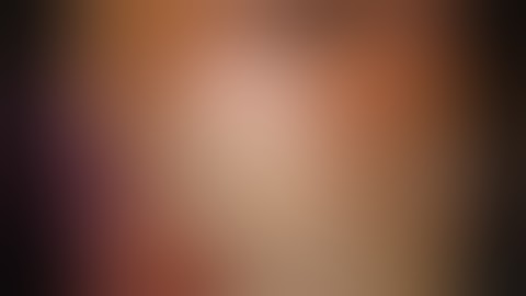 TME for rectal cancer laparoscopic dissection of the Holy Plane using 3 directional 3D retraction