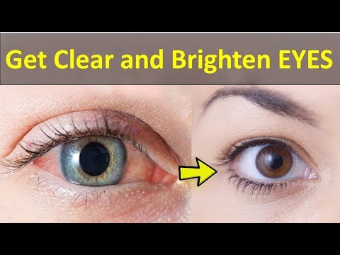 Como ter olhos claros e brilhantes – 6 dicas para clarear o branco dos olhos