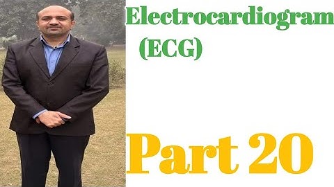 Electrocardiogram(ECG)::How to Diagnose Left Bundle Branch Block(LBBB)from ECG Paper.