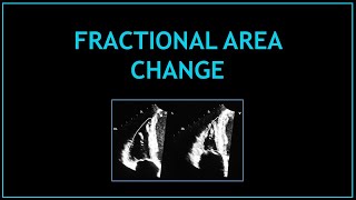 Fractional Area Change (FAC) - Right Heart Assessment!