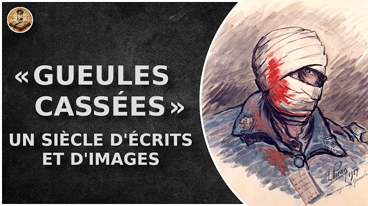 Représenter les « Gueules Cassées » : un siècle d'écrits et d'images | DHEH [ST]
