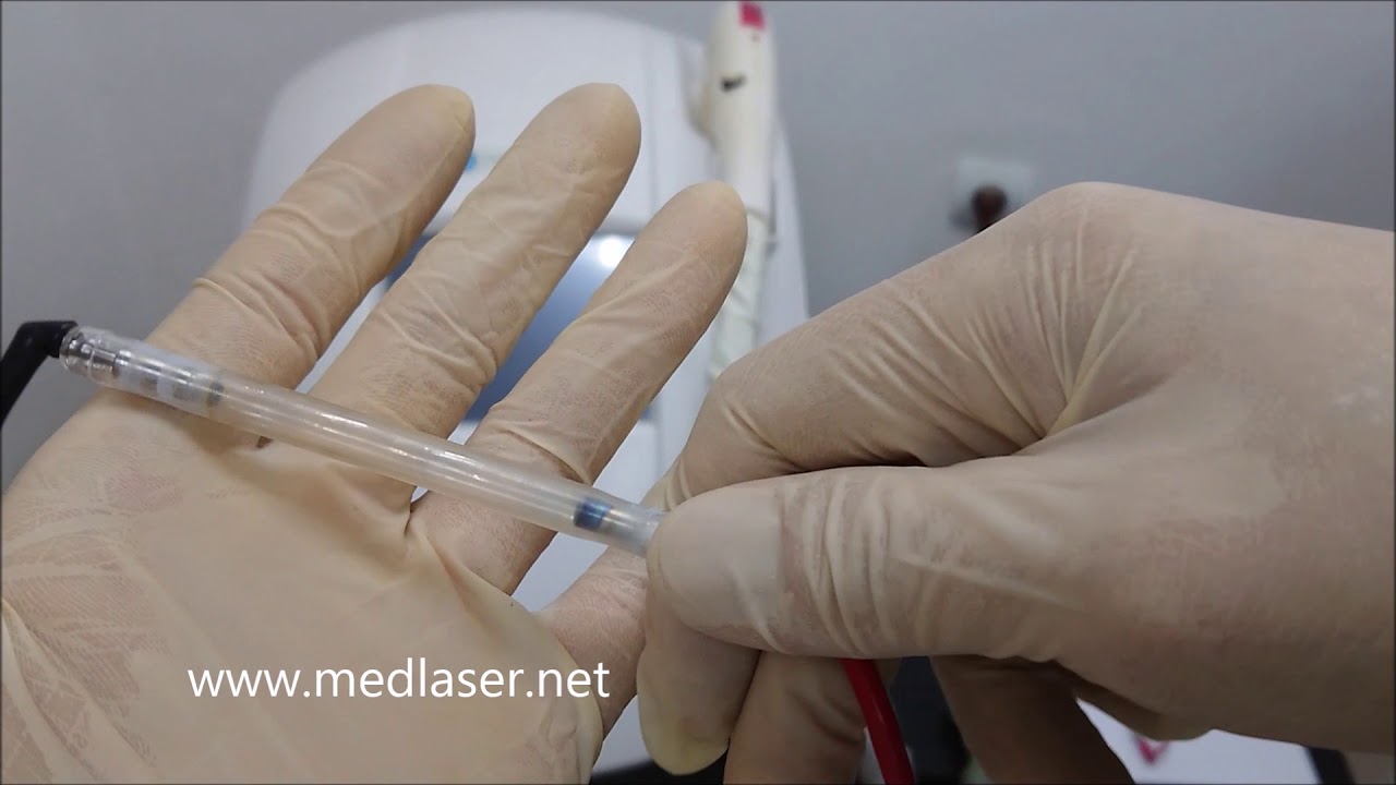 Ремонт лазерного Elos эпилятора HONKON M40e - YouTube