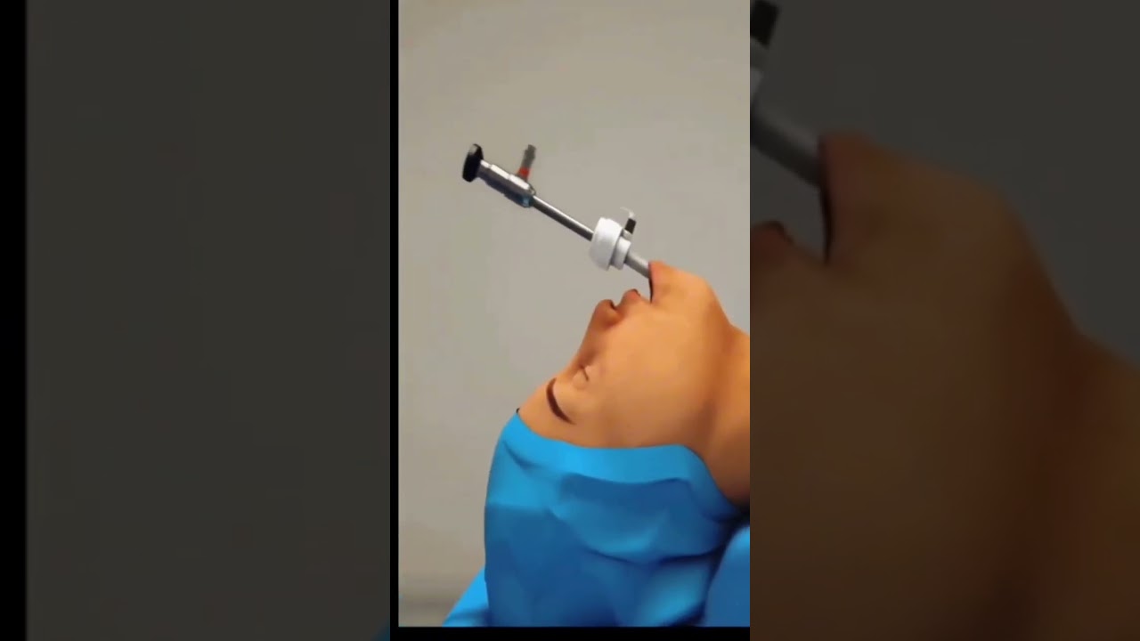 Thyroid Surgery Procedure Explained | Step-by-Step Thyroidectomy | Medical Lecture | college Planet