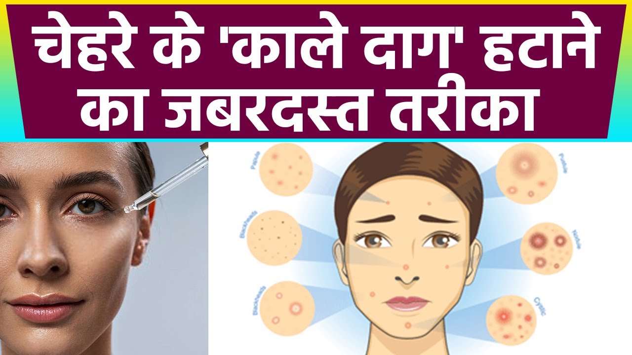 tranexamic acid and glutathione tablets uses for skin in hindi Anthocyn-TX Tablet , , , Solve hyperpigmentation spots with Mary&May
