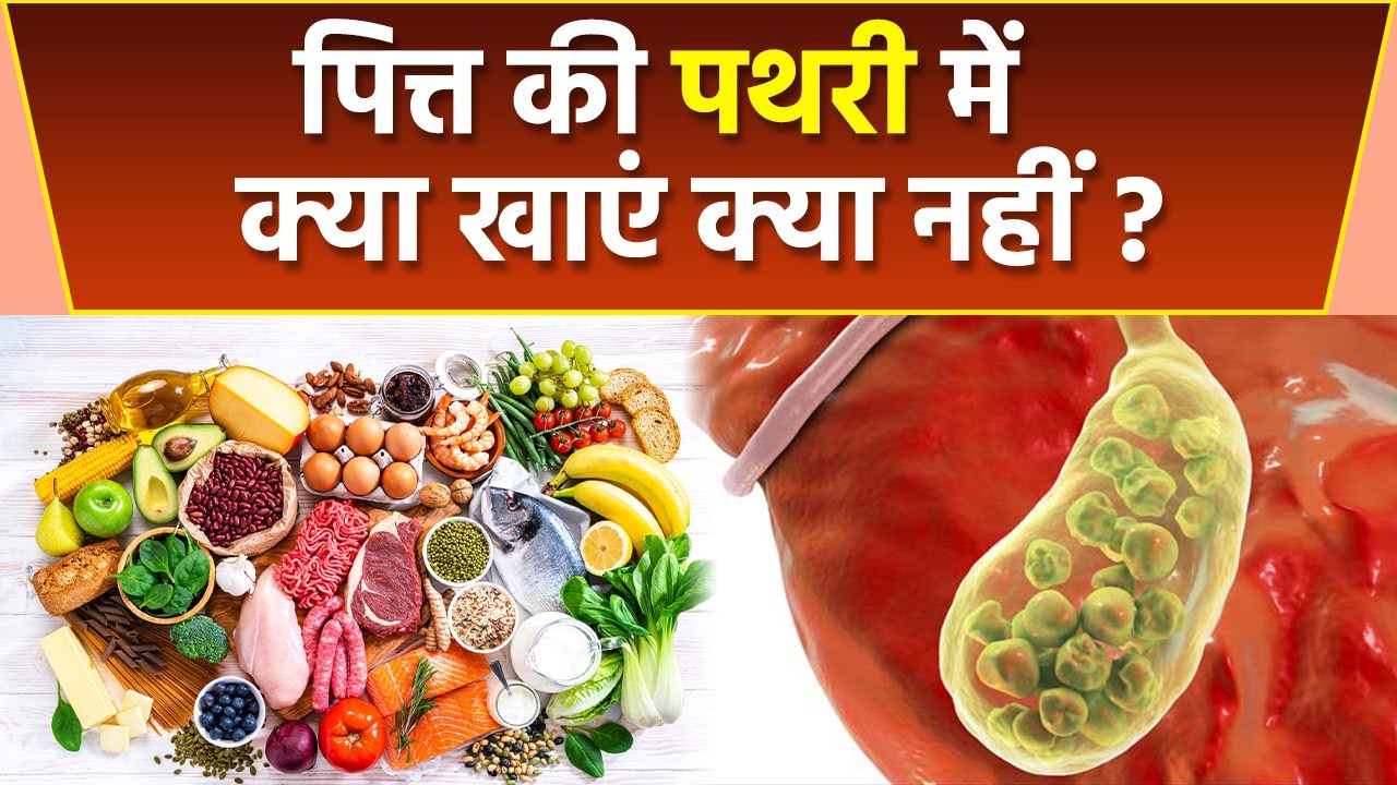 Gallbladder Stone में क्या खाएं क्या नहीं ? Gallbladder Stone me kya