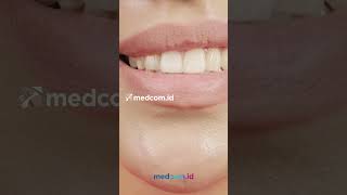 Cara Mencabut Gigi Sendiri Di Rumah, Awas Jangan Salah Langkah