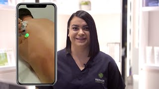 Laser Hair Removal for Men