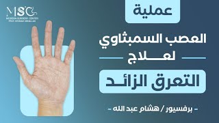 عملية العصب السمبثاوي لعلاج التعرق الزائد - بروفيسور هشام عبدالله