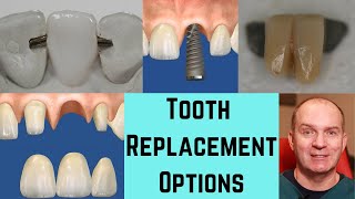 5 ways to replace a missing front tooth. by Very Nice Smile Dental 1,226 views 1 month ago 15 minutes