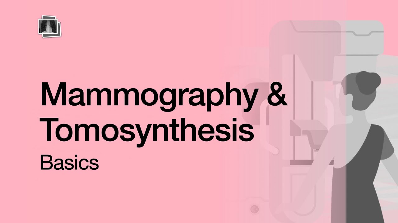 Mammography & Tomosynthesis Basics - YouTube