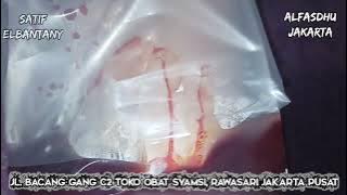 Fasdhu untuk gangguan Asamm Urat kesemutan