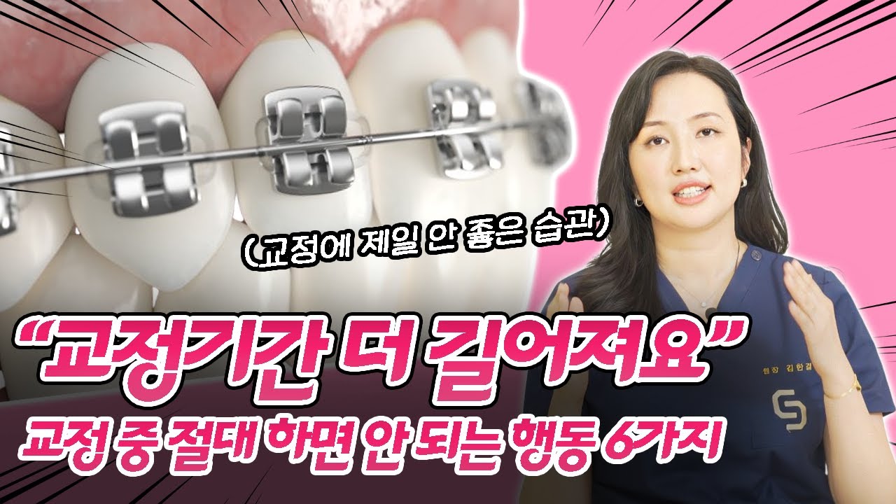 치아교정 기간을 단축시키려면 이 행동은 절대 하지 마세요 l 교정 중 하면 안 되는 행동 6가지 #치아교정 #교정전문의 #교정중생기는 #습관 I 스마일뷰치과 러블리 김원장