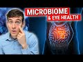 SUPRISING Connection Between Gut Microbiome and Eye Health
