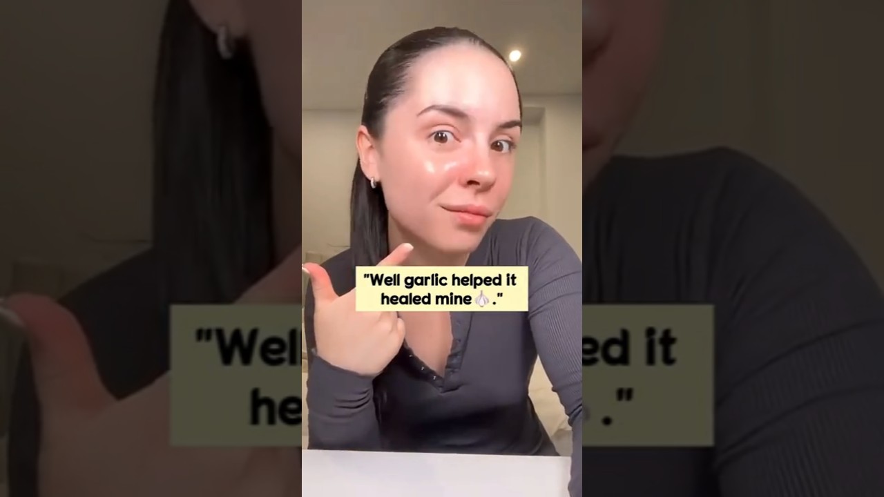 Clear Skin Naturally 🍯🧄 Eat 2 Garlic Honey Cloves Daily for Acne-Free Glow 