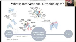 Avoid Elective Surgery | Webinar Replay | Regenexx Des Moines