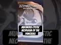 4/100 day challenge | Random Radiology Dump | #radiologyshorts #pancreatic_tumor #mri