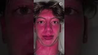 Unstoppable Force Vs Immovable Yatoro - Esl Dota 2