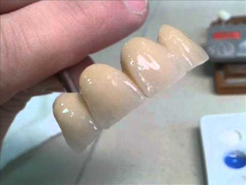 dents ceramiques ceramic teeth - YouTube