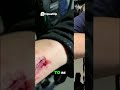 Heated Debate After Graphic Assault Photos Go Viral