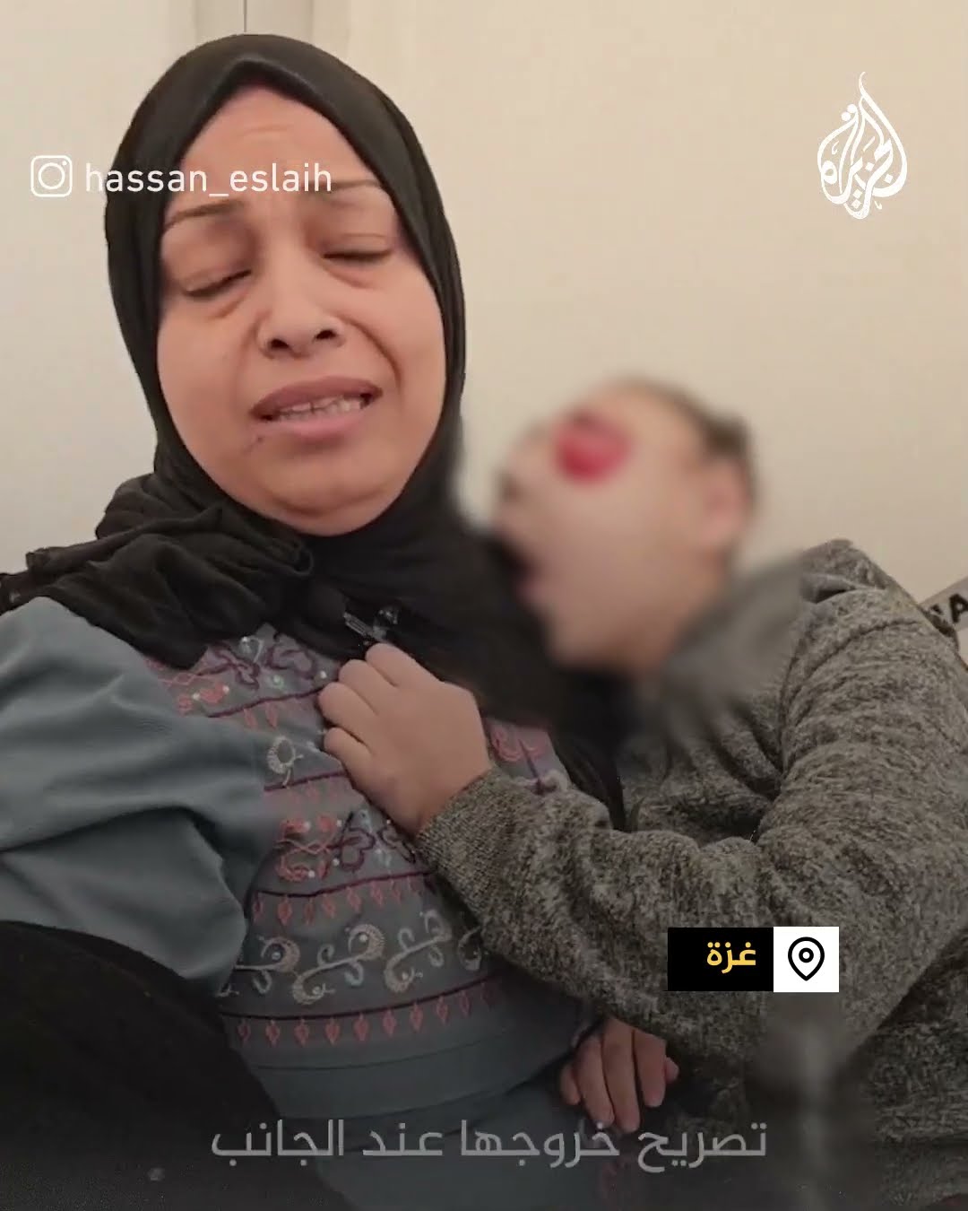 والدة طفلة غزية تعاني ورم بعينيها تناشد علاجها بالخارج