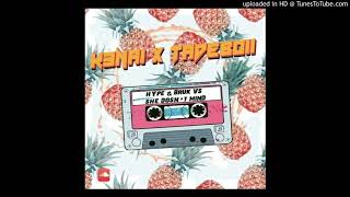 Hype & Bruk Vs. She Doesn’t Mind (K3NAI x Tadeboii)