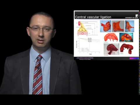 Complete Mesocolic Excision: Pathological Quality Control