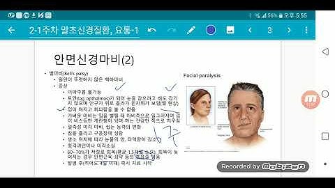 2 1 1 말초신경장애환자 간호안면신경마비, 삼차신경통