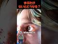 まぶたの欠損したら? #実話 #雑学 #事故 #プチ知識