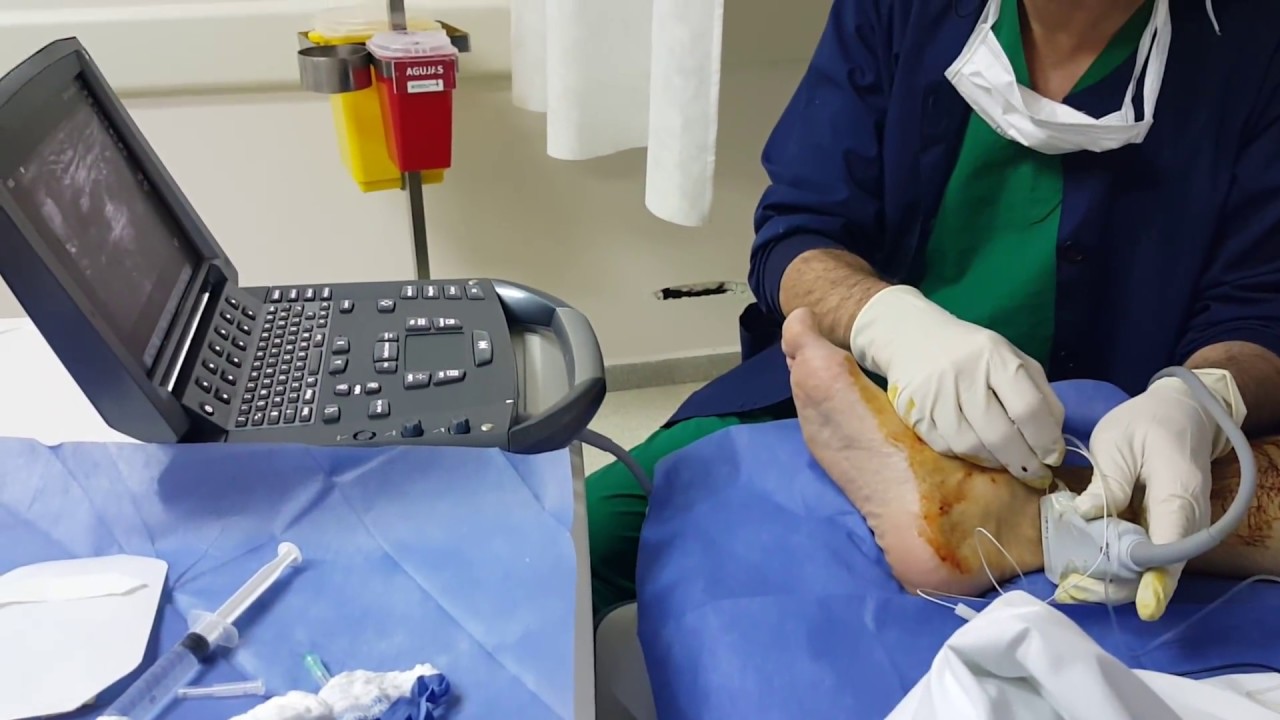 Dr. German Pace :: Cirugía del Pie, image size:1280x720