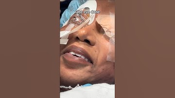 Eye Color Change with ColorEyes procedure-info at MyColorEyes.com #coloreyes #eyecolor #shorts