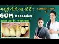 masude niche jane ka ilaj | receding gums treatment natural | मसूड़े नीचे जा रहे हैं | COMMENT BOX #3