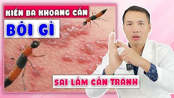 Trẻ bị KIẾN BA KHOANG ĐỐT thì xử lý thế nào? Kiến ba khoang cắn BÔI THUỐC GÌ? | DS Trương Minh Đạt