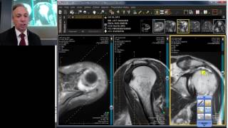 MRI Case Review: Shoulder Deep Dive 5
